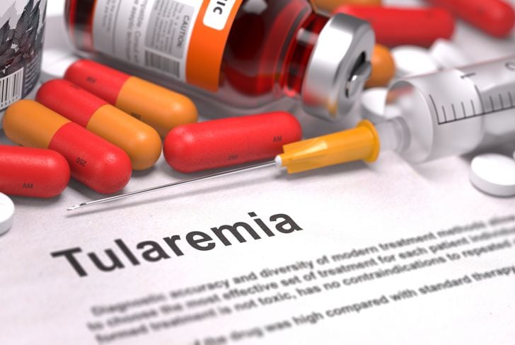 Quali sono le cause, i sintomi e i trattamenti della tularemia? 5