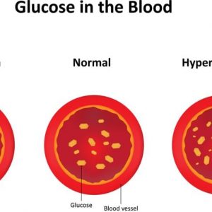 Segni di abbassamento della glicemia