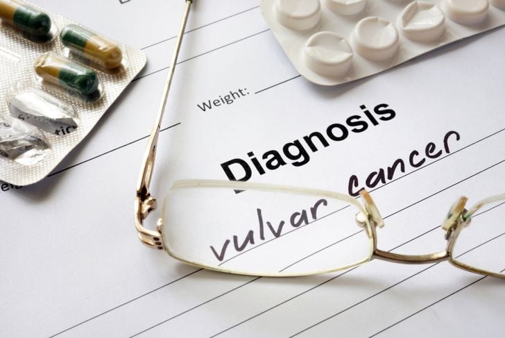 10 sintomi del cancro vulvare 15