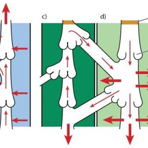 10 Trattamenti per il linfedema 10 Trattamenti per il linfedema