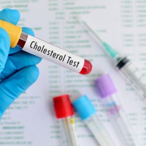 10 importanti benefici dei grassi monoinsaturi 10 importanti benefici dei grassi monoinsaturi