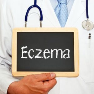 Cause, sintomi e trattamento dell’eczema nummulare