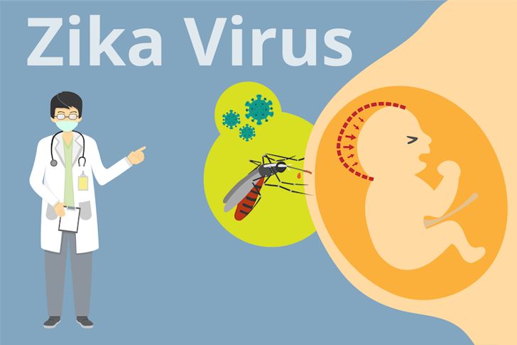 10 cose da sapere sul virus Zika e la gravidanza 7