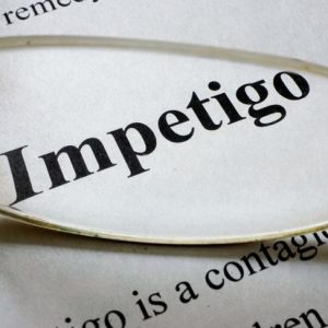 Domande frequenti sull’impetigine Domande frequenti sull’impetigine