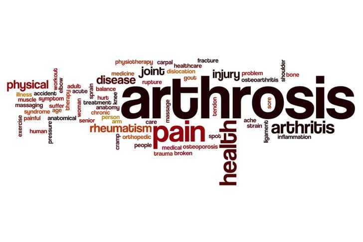 Domande frequenti sull'artrosi 7