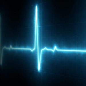 Quando preoccuparsi delle contrazioni atriali premature Quando preoccuparsi delle contrazioni atriali premature