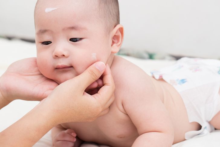 L'acne infantile è un problema comune 17