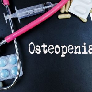 10 sintomi di osteopenia