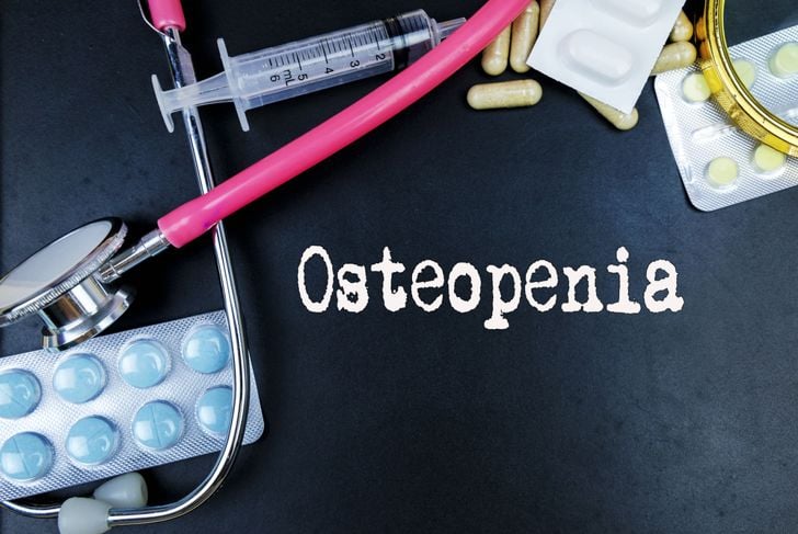 10 sintomi di osteopenia 1