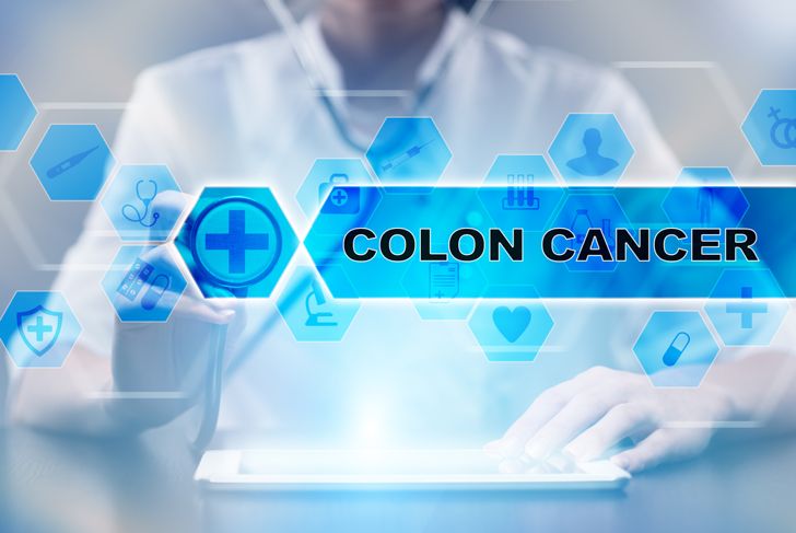 Trattamenti per il cancro al colon in base allo stadio 7