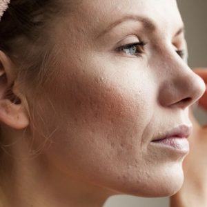 10 sintomi di carenza di nutrienti 10 sintomi di carenza di nutrienti