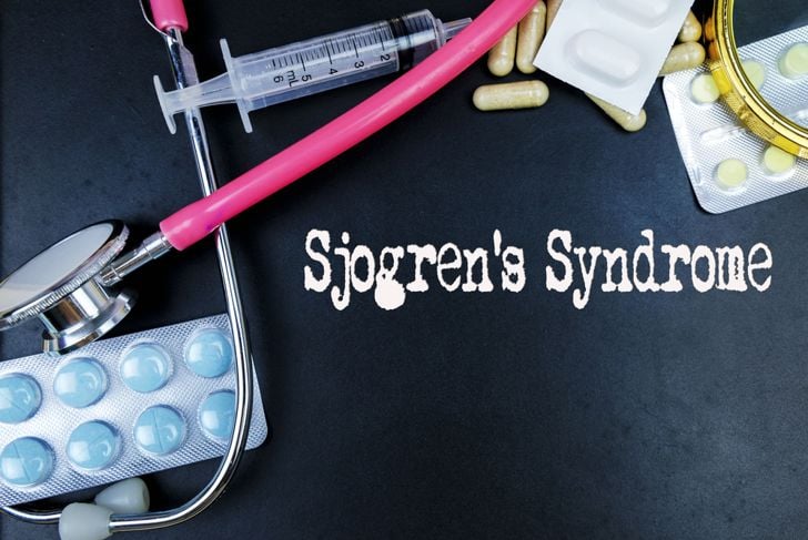 10 sintomi della sindrome di Sjogren 9