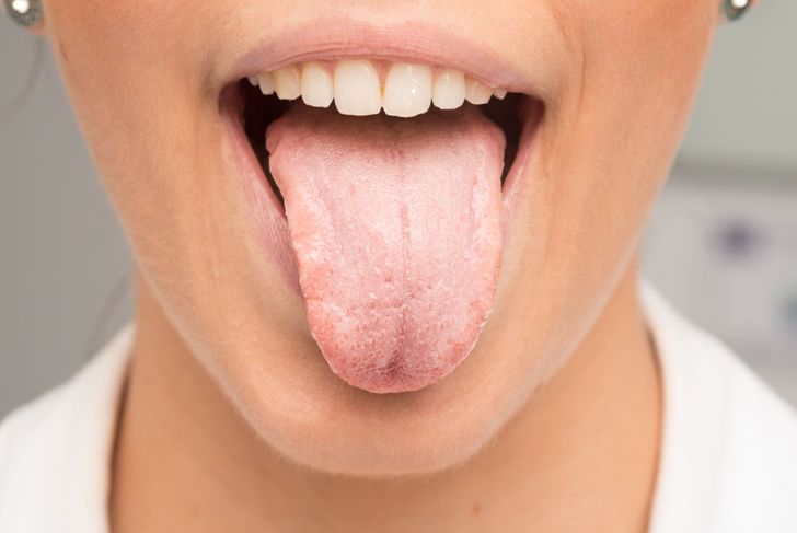 Come i raschietti per la lingua sono utili per la salute generale 3