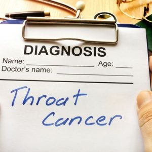 10 sintomi del cancro alla gola