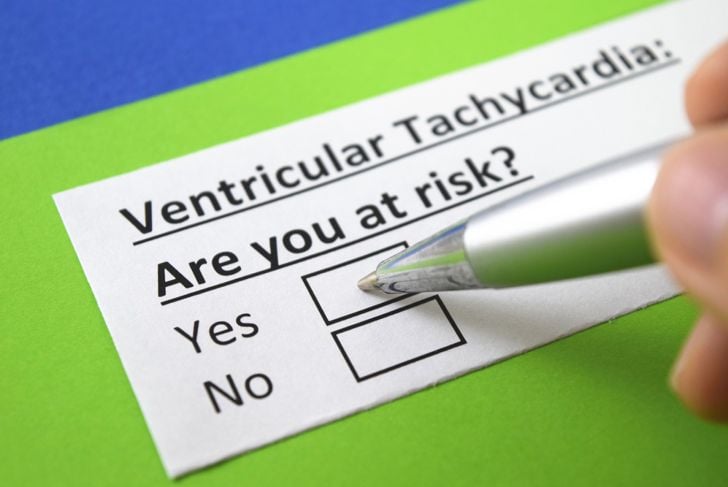 Che cos'è la tachicardia ventricolare? 11