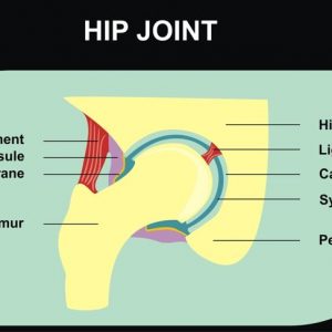 Strappi del legamento della spalla e dell’anca