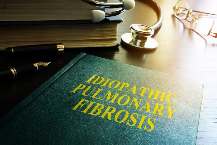 10 sintomi della fibrosi polmonare idiopatica (IPF) 9