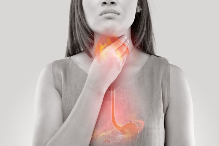 Che cos'è l'esofagite? Sintomi e trattamento 3